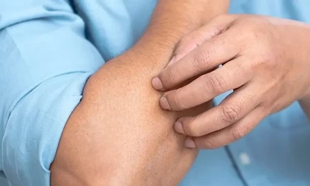 শীতে কেন চুলকায় ত্বক